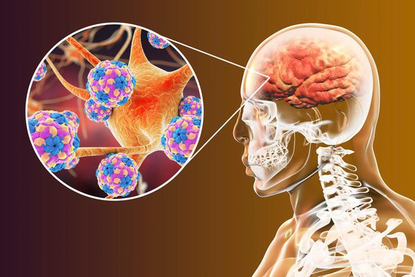 Neurodegenerative Diseases