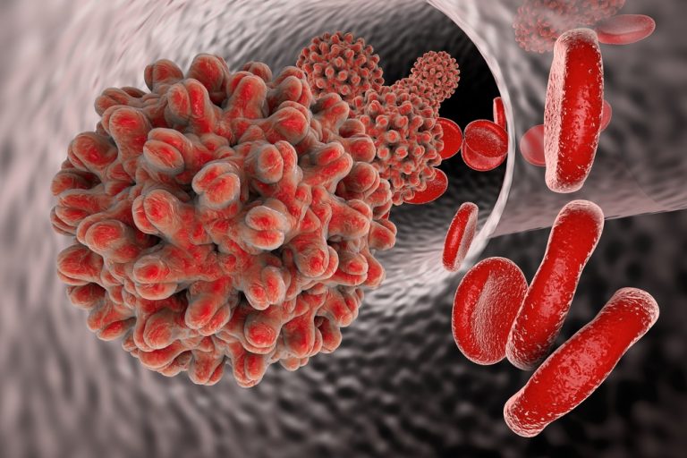 Hepatitis is a viral infection that affects the liver