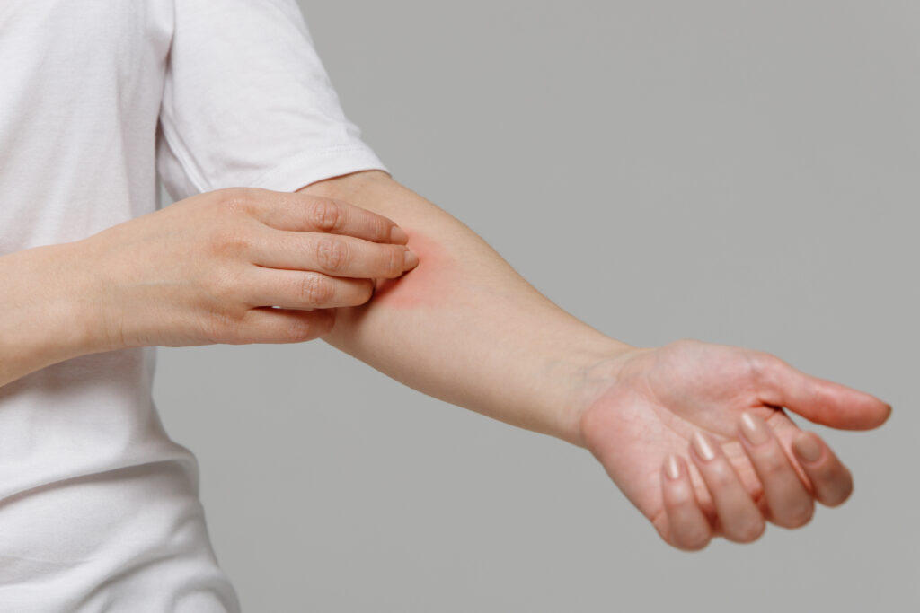 Understanding Syphilis: Symptoms, Transmission, and Treatment
